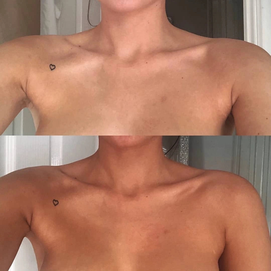 SkinnyTanCoconutWaterTanningMistSelfTanBeforeandAfter.webp