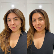 Skinny Tan Notox Drops Before and After results image